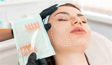 how long does a facelift take to heal