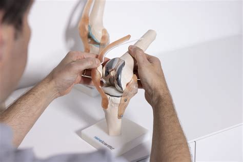 Knieendoprothesen