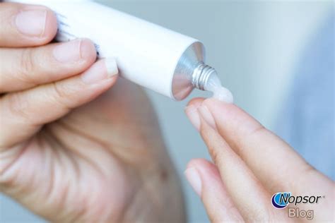 steroid creams  psoriasis benefits  downsides nopsor usa