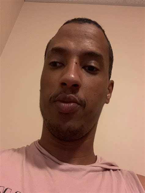 Surgery next week.. excited and nervous at the same time 😅 : r/Strabismus