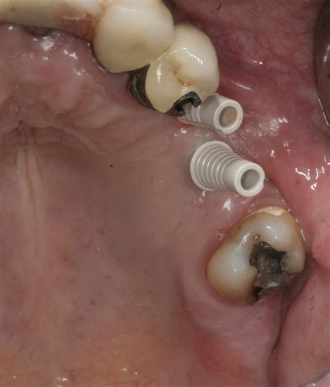 Posts – Page 2 – Smile By Design NY Blog