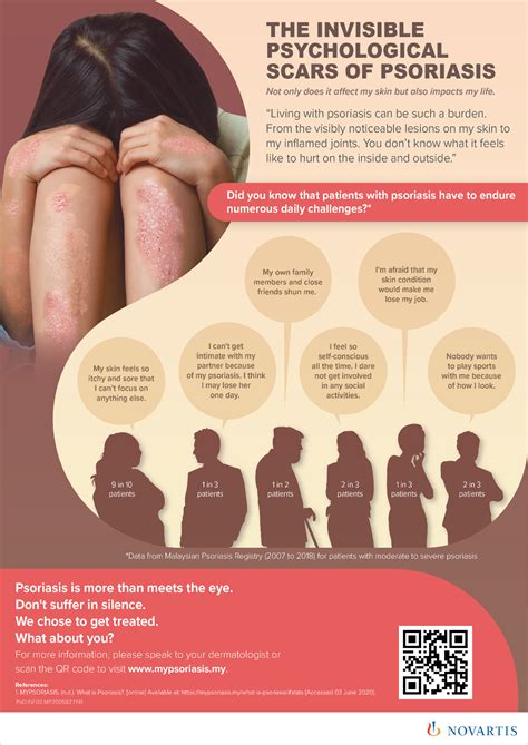 Pasi Psoriasis Area And Severity Index 5