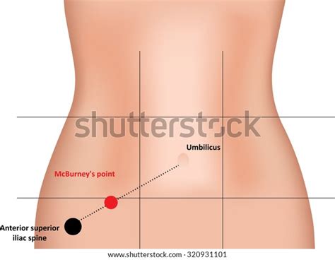 7 Mcburney's Point Images, Stock Photos, and Vectors | Shutterstock