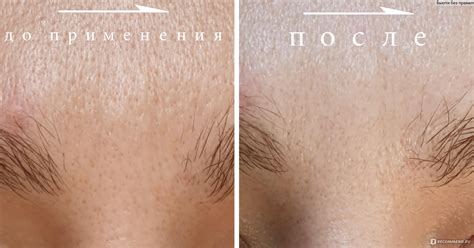 Тканевая маска для лица Lindsay Home Aesthetics Perfect Solution ...