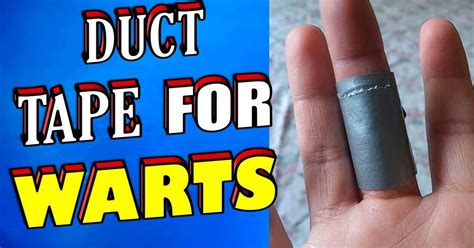 Duct Tape for Removing Warts – This Treatment is Backed by Science - Health And Love Page