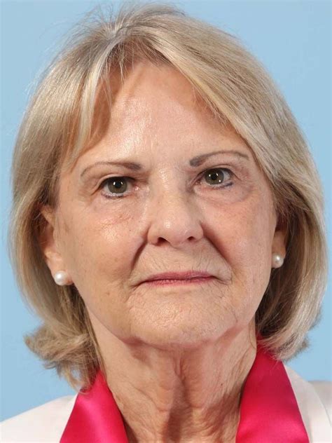 a face lift 10