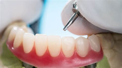 Walmart Denture Glue: Affordable Repair Solutions - Hunter Games Magazine