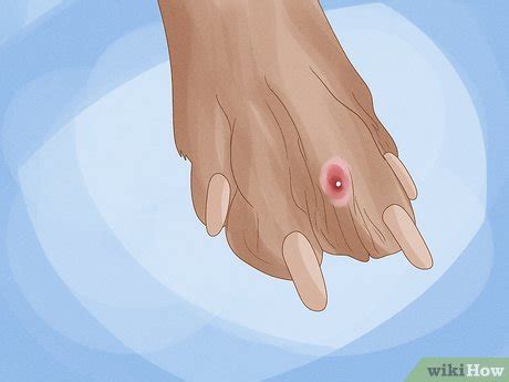 how to treat red paws in dogs