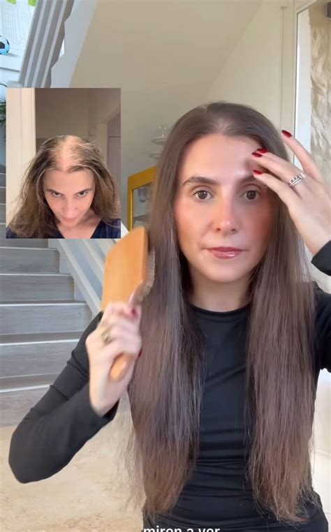 Marcela García habla sobre la alopecia y se muestra sin peluca por