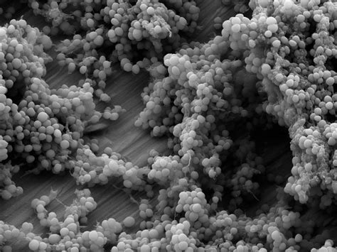 Staphylococcus epidermidis, Biofilms, and Antibiotic Resistance - Owlcation