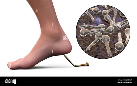Infection transmission. Conceptual illustration showing an old rusty ...