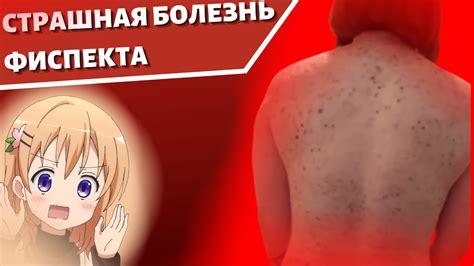 СТРАШНОЯ БОЛЕЗНЬ ФИСПЕКТА - YouTube