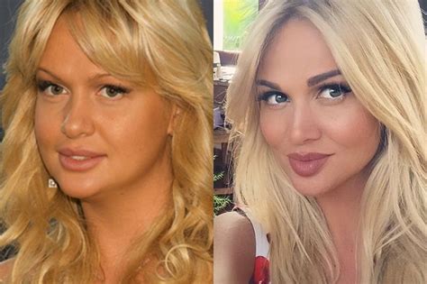 Как выглядела до пластики и какие операции делала Виктория Лопырева ...