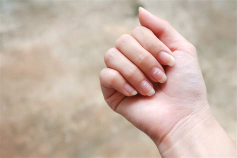 How To Get Rid Of White Spots On Your Nails