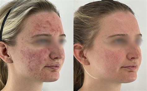 Scort Mn: The Hidden Risks You Need To Know About (Before It's Too Late!) Image 5