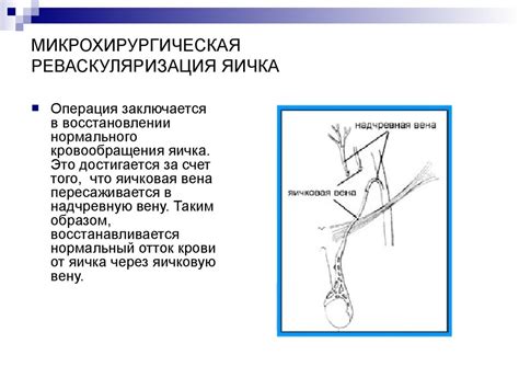 Варикоцеле. Расширение вен семенного канатика - презентация онлайн