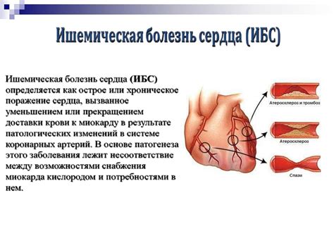 Сердечно-сосудистые заболевания - презентация онлайн