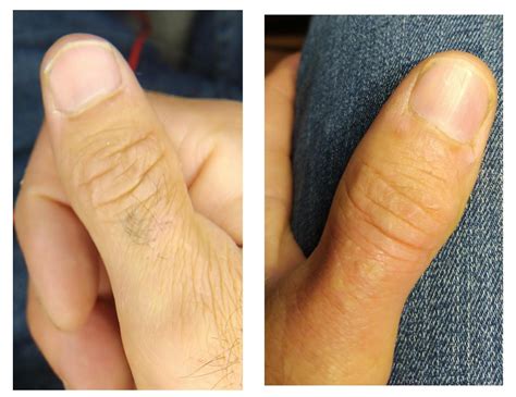 diy electrolysis started rtranstimelines