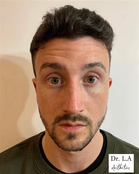 The story of dr lynette nusbacher before and after is unique 22