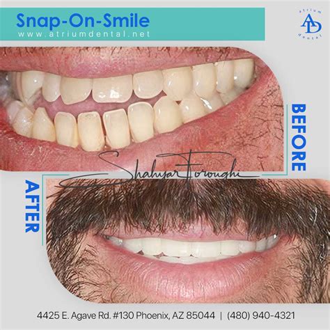 teeth     snap  smile