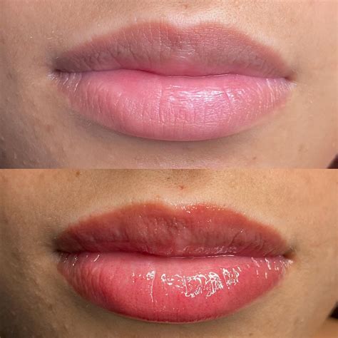 O Que É Micropigmentação Labial