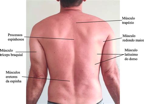 Região Dorsal Onde Fica - RETOEDU 