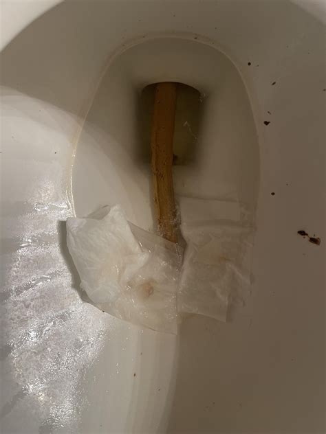What does this look like? : r/poop