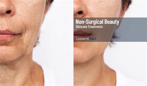Effective Solutions to Eliminate a Sagging Chin and Restore a Youthful Look - Hunter Games Magazine