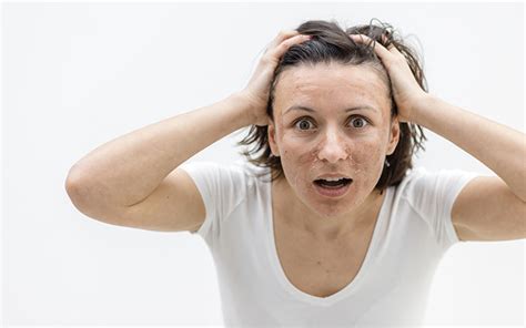 Pale Skin: What Is It & How To Make It Glow? – Vedix