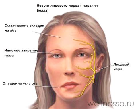Асимметрия лица: причины, как исправить + методы лечения