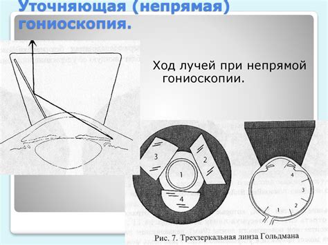 Гониоскопия - презентация онлайн