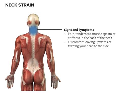 Rotator Cuff Strain - The Climbing Doctor