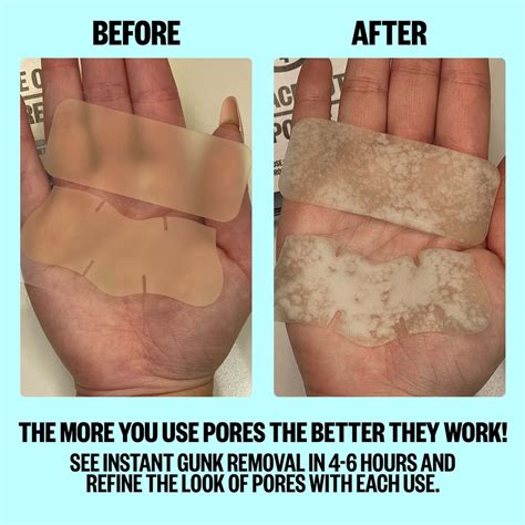 diy pore strips 5