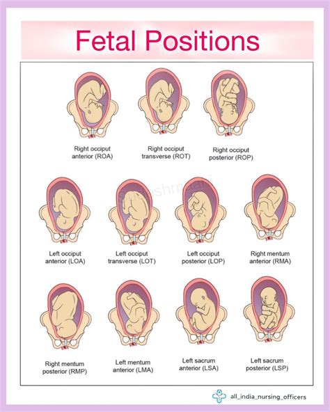 The Medical Mind on Instagram: "Fetal positions obstetrics Ideal fetal