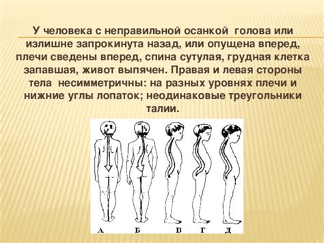 Осанка