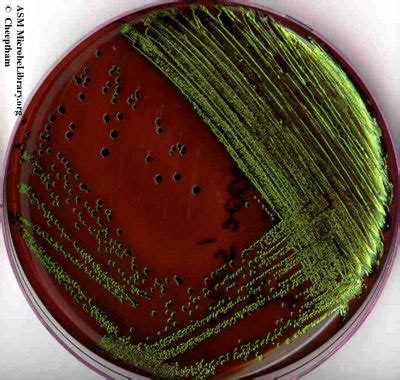 solved   picture shows  growth  bacteria  cheggcom