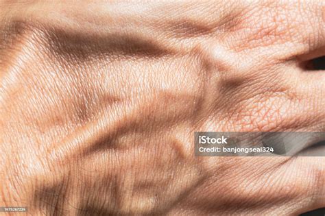 Macro Human Hand Skin Macro Human Hand Texture The Texture Of The Skin ...