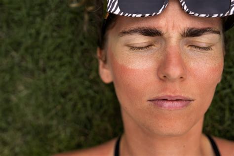 How to Reverse Sun Damage on Your Skin - Prime Med Spa