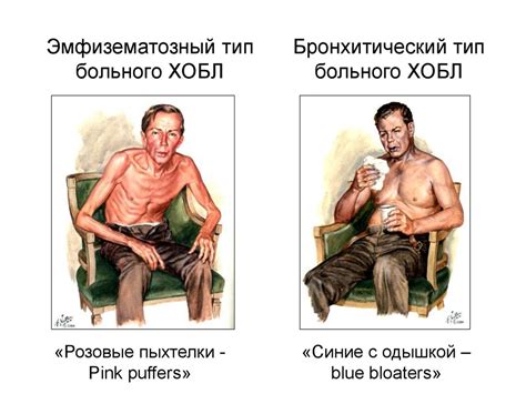 Хронические обструктивные болезни легких - презентация онлайн