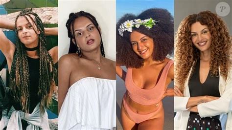 Gabriela Loran Antes E Depois Da Cirurgia