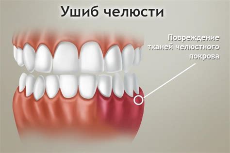 Онемение челюсти немеет нижняя челюсть причины
