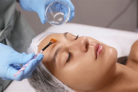 Chemical Peel in Walnut Creek, CA - Dr. Zaka