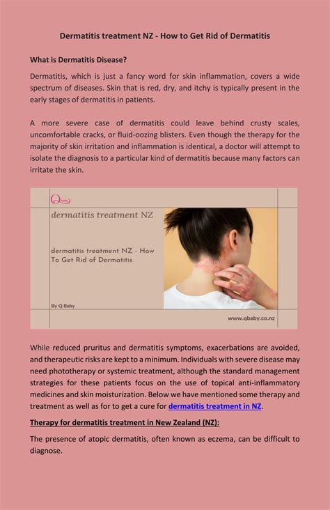 PPT - dermatitis treatment NZ - How To Get Rid of Dermatitis PowerPoint ...