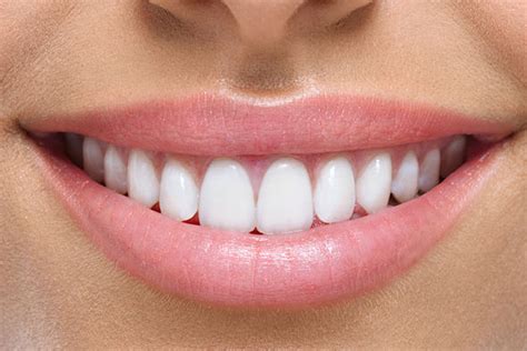 Dental Smile Images Hd - 1170x780 Wallpaper - teahub.io