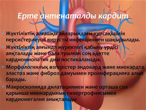 Туа пайда болған кардит. Клиникасы. Диагнозы - презентация онлайн