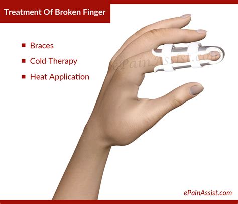 Broken Finger: Treatment, Causes, Symptoms, Signs