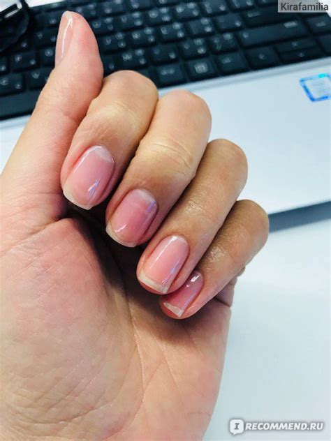Лак для ногтей IQ BEAUTY Скорая помощь для восстановления ногтей/Quick ...