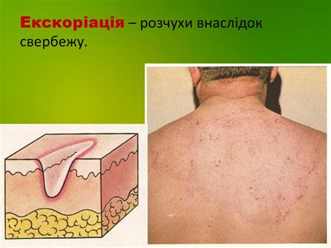 Анатомія та фізіологія шкіри. Первинні та вторинні елементи шкіри ...