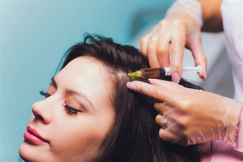 Guide to PRP Scalp Injections for Hair Loss | Vibrant Dermatology
