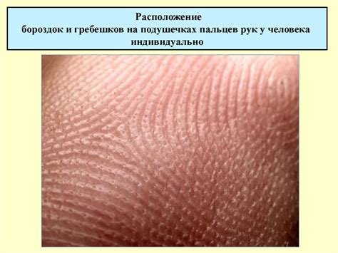 Кожа человека - презентация онлайн